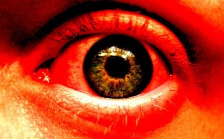 Red eyes from grow light strains. Protect your eyes so this doesn't happen to you!
